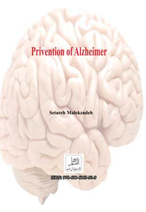 پیشگیری از آلزایمر